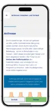 ActiveTEP Knie App-Screen Arthrose
